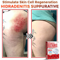 LushSter™ – Say Goodbye to Skin Tags.