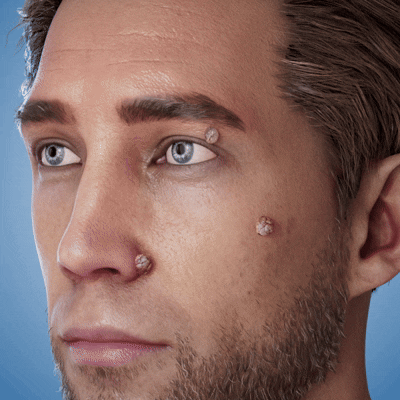 LushSter™ – Say Goodbye to Skin Tags.