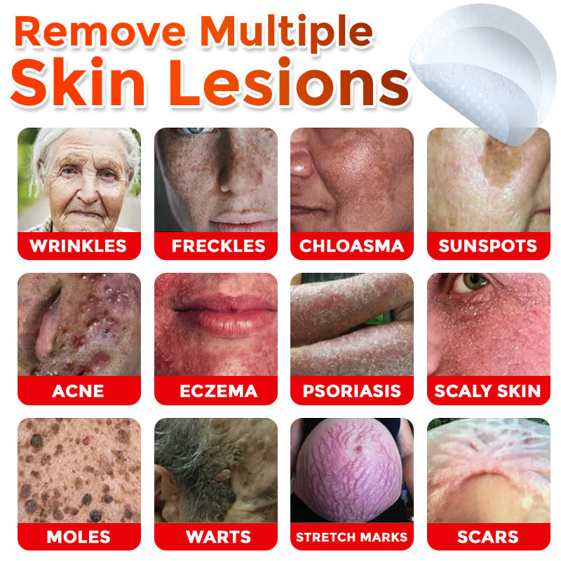 LushSter™ – Say Goodbye to Skin Tags.